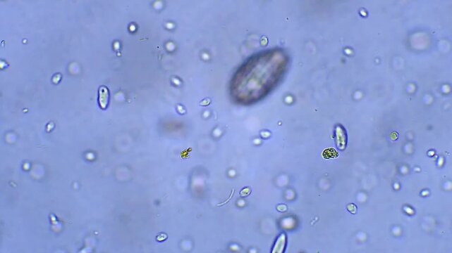 Micro organisms - Ciliates, microscope magnification