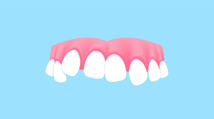 Upper teeth (Crooked) illustration vector design. Dental care concept.