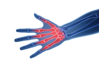Isolated illustration of the bones of the hand, with red carpal bones, metacarpals and blue phalanges