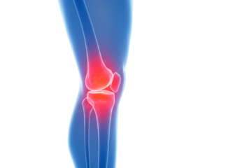 Isolated painful knee joint anatomy 3D render representing medical illness or injury issue
