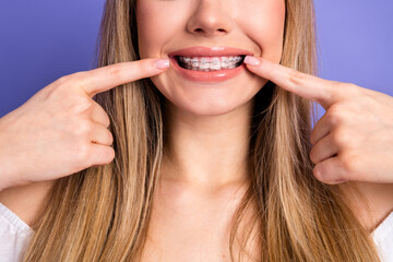 Lovely young woman with braces showcasing a perfect smile pointing at her teeth on a vibrant...