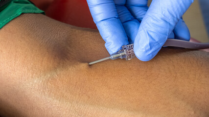 Macro angle showing a healthcare worker wearing gloves inserting a needle into a patient’s arm...