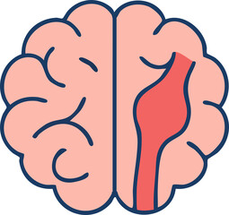 This is a flat vector illustration of a human brain with a highlighted red bulging blood vessel on the right side, representing a brain aneurysm.