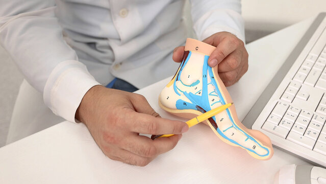 Anatomical foot model on doctor table while consultation in orthopedics center. Treatments for flat feet and pes planus