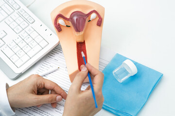 Doctor shows a swab procedure on a uterine model, highlighting women's health care in a clinic....