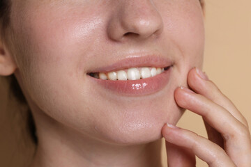 Obraz premium Smiling woman after dental aligners treatment on beige background, closeup