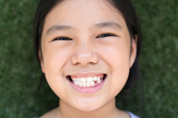 closeup face asian child lost one baby or milk tooth or beautiful kid girl smile white teeth 1 broken drop tooth on 11 years old or elementary and most permanent teeth for dental background on green