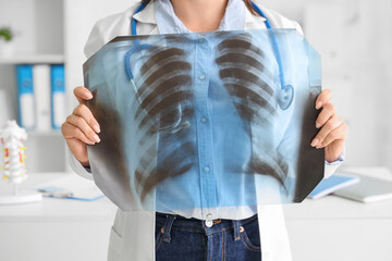 Female doctor with x-ray image of lungs in clinic, closeup