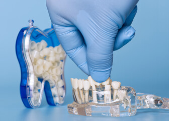 Placing dental crown on model with gloved hand