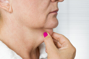 Older women holds the sagging neck skin
