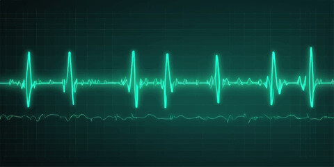 Medical monitor displaying a dynamic green heartbeat on an EKG graph, illustrating a steady pulse rate