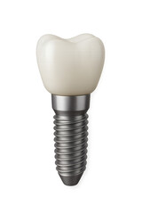 3D render of dental implant with metal screw and crown, medical prosthetic model for dentistry.
