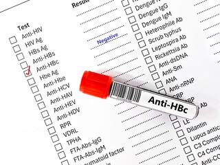 Blood sample tube negative result for anti-HBc.