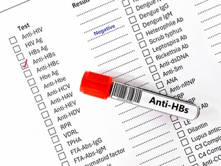 Blood sample tube negative result for anti-HBs.