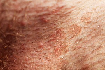 dark spots on the skin, swelling. Skin diseases
