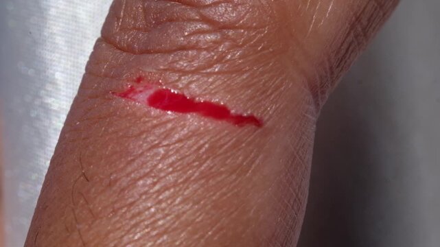 Footage of a brown-skinned man's bleeding index finger. Close-up motion videography of an injured finger. Workplace accident. Blood flowing motion. High Quality 4K Resolution