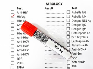Blood sample tube and paper order request for HIV Ag test analysis.