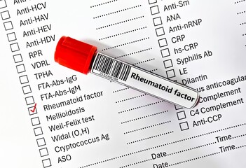 Blood sample tube and paper order request for rheumatiod factor test analysis.