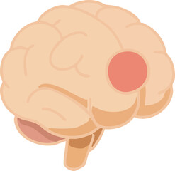 This illustration depicts a human brain with a highlighted red circular spot, symbolizing brain injury, stroke, or localized neurological damage.