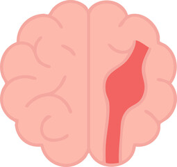 This is a flat vector illustration of a human brain with a highlighted red bulging blood vessel on the right side, representing a brain aneurysm.