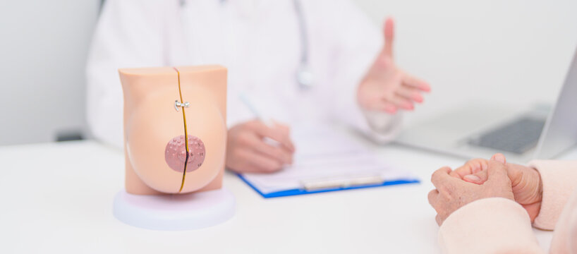 woman Patient consultation with doctor for Breast Augmentation Surgery, October Breast Cancer Awareness month, implant, Diagnosis, Beauty woman enlargement and medical healthcare concept - Powered by Adobe