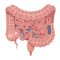 Detailed Illustration of Human Colon with Bacteria and Microbes in Pink and Blue