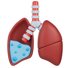 Pulmonary edema 3d medical illustration, shows fluid accumulation in lung.