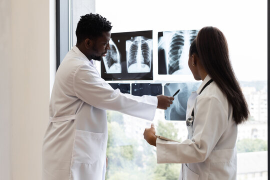 Male and female doctors of diverse backgrounds examining chest X-ray images by window. Collaborative medical consultation in modern clinic setting, emphasizing teamwork, analysis