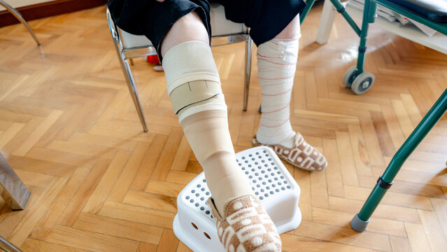 Elderly Woman with Compression Bandages Resting Her Legs