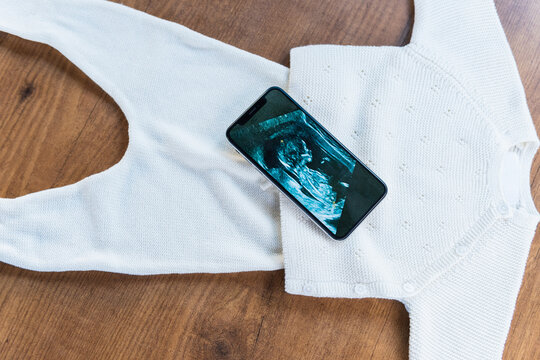 Baby clothes with ultrasound image, baby bodysuit. Still life of child products. Newborn background. Minimalist style photography of baby shower, pregnancy announcement