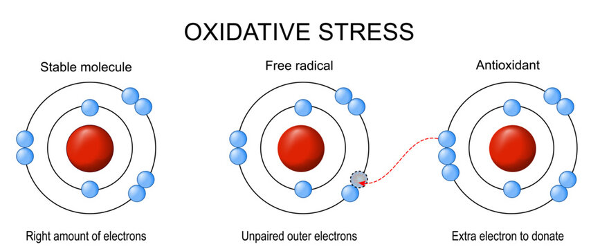 Oxidative stress. Free radical, stable molecule and Antioxidant