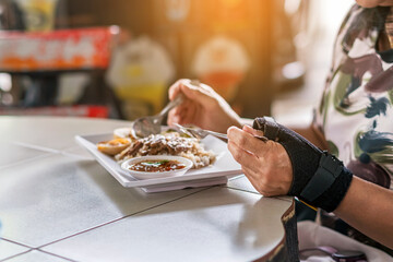 Hands of woman with thumb spica finger splint uses spoon and fork  to eat. Woman uses wrist support brace and have a meal. Hand in cast. female hands with orthosis. Injured hand of woman eating food.