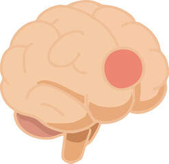 This illustration depicts a human brain with a highlighted red circular spot, symbolizing brain injury, stroke, or localized neurological damage.