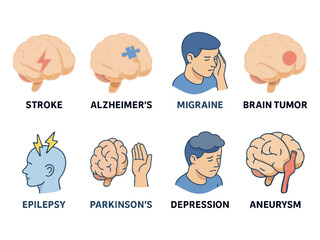 This image is an illustrated medical chart depicting various brain and neurological disorders, including aneurysm, brain tumor, Alzheimer’s, stroke, depression, Parkinson’s, epilepsy, and migraine wit
