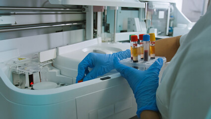 A laboratory technician in gloves handles blood samples stored in tubes for analysis in a medical facility.