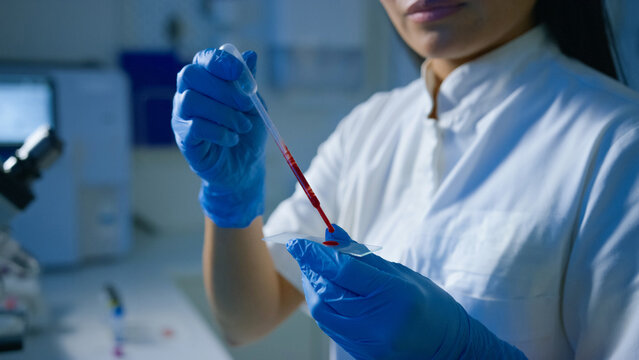 A lab technician uses a pipette to transfer blood samples onto a slide for analysis in a modern laboratory setting.
