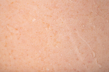 Wet human skin with water drops closeup. Sweat healthy body, macro shower drops on woman skin