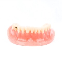 Obraz premium Dental Prosthesis with Gold Implant on White Background.