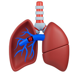 Pulmonary embolism 3d illustration. Lung anatomy model with blood clot blocked pulmonary artery.