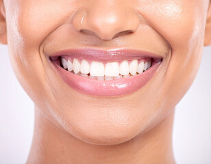 Naklejka premium Radiant smile with glossy pink lips and white teeth image
