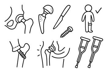 Hip Replacement Doodle. Hand-drawn doodle illustration hip replacement artificial joint, metal implant, hip prosthesis, surgery