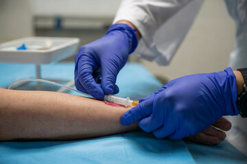 Close up of medical professional inserting I V catheter into patient arm IV insertion intravenous