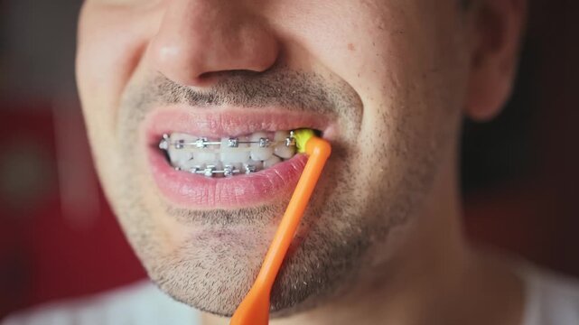Cleaning metal braces with a toothbrush in longitudinal movements, shot close-up