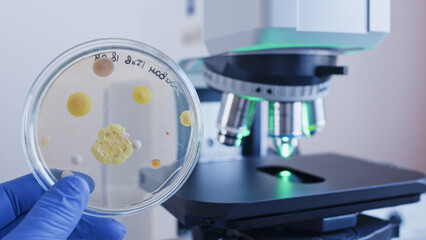 Petri dish with bacterial colonies against the background of a working microscope.
