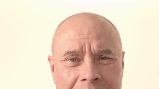 Mature bald man facing hair loss, no comb needed, considering trichology solutions, male baldness and growing need professional hair restoration, Hairless head, seeking medical help regrowth therapy