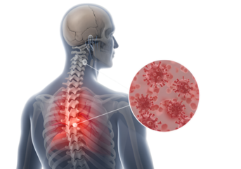 Medical illustration of back pain, possibly viral origin, showing skeletal structure and highlighted pain area.