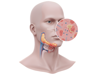 Medical illustration showing a cross-section of a human head, highlighting the nasal passages and throat.