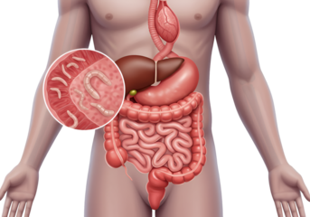 Medical illustration showing the human digestive system with a magnified view of parasitic worms.