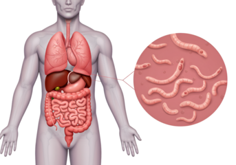 Detailed anatomical illustration of the human body, highlighting internal organs and parasitic worms.