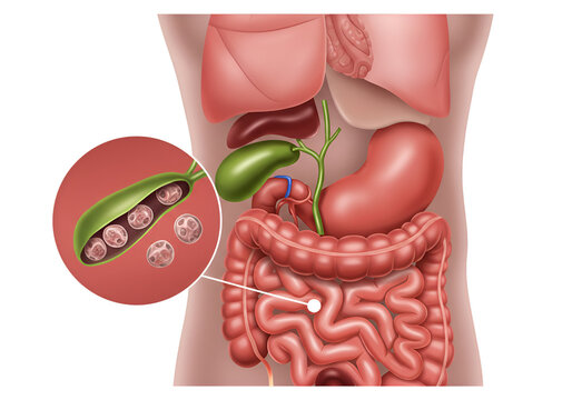 Gallbladder with gallstones; detailed anatomical illustration showing digestive system organs.